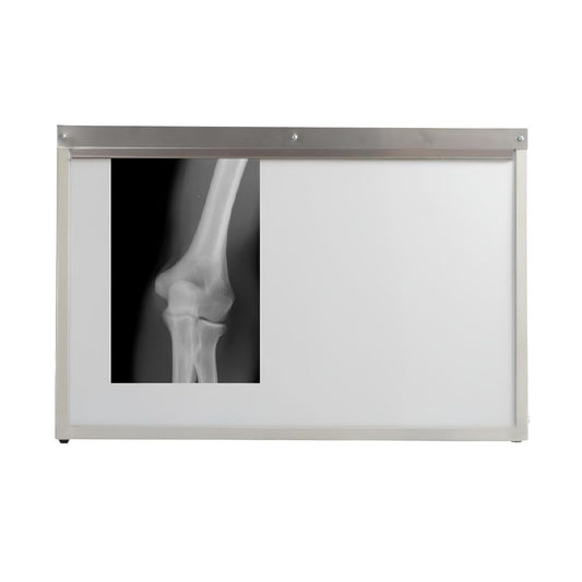 Negatoscopio Esmaltado para Áreas de Radiología e Imagenología - NEXUS FLEX VOM1610 - 2 Placas Luz Led - Cuerpo Sólido de Lámina Acero Negatoscopio Negatoscopio Médico Negatoscopio Hospitalario Negatoscopio Para Consultorio Negatoscopio De Pared Negatoscopio De Mesa Negatoscopio De Luz LED Negatoscopio Radiológico Negatoscopio Para Rayos X Negatoscopio Clínico Negatoscopio Portátil Negatoscopio Doble Negatoscopio Sencillo Negatoscopio Digital Negatoscopio Profesional Negatoscopio Para Diagnóstico